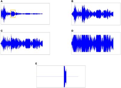 A Wasserstein generative adversarial network with gradient penalty for active sonar signal reverberation suppression